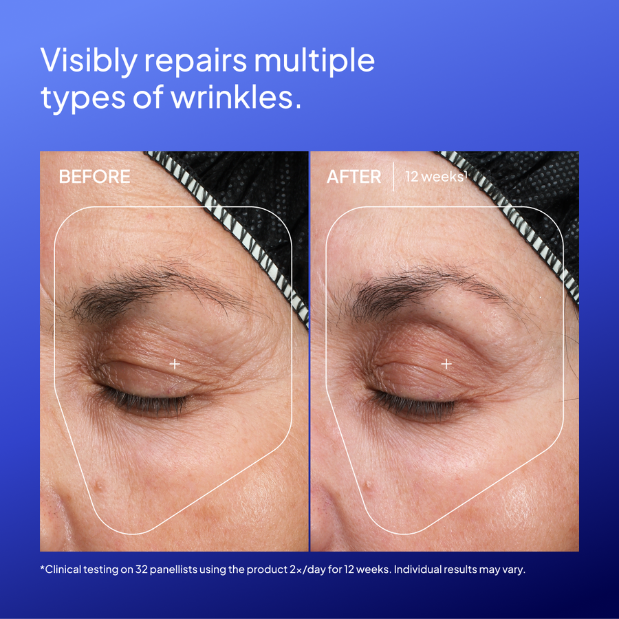 ghk cu wrinkles before and after Copper Amino Isolate Serum 3 1:1 (CAIS3)
