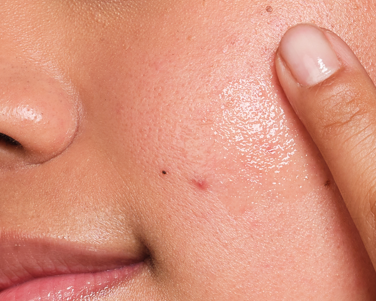 Visibly Clearer Skin.